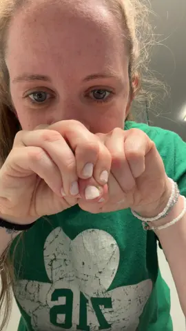 Ew but also wow. Had some sort of hangnail situation that desperately needed to be popped💣💥 #pop #pimple #fyp #asmr 