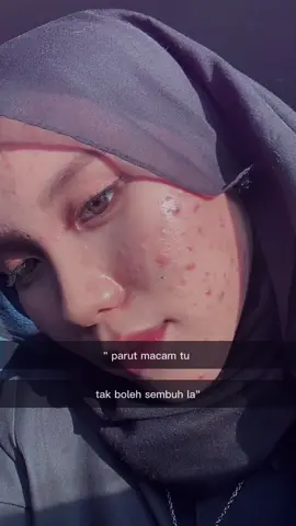 moisturizer is moisturizing 🩵 #serumviral #lumixpertMY