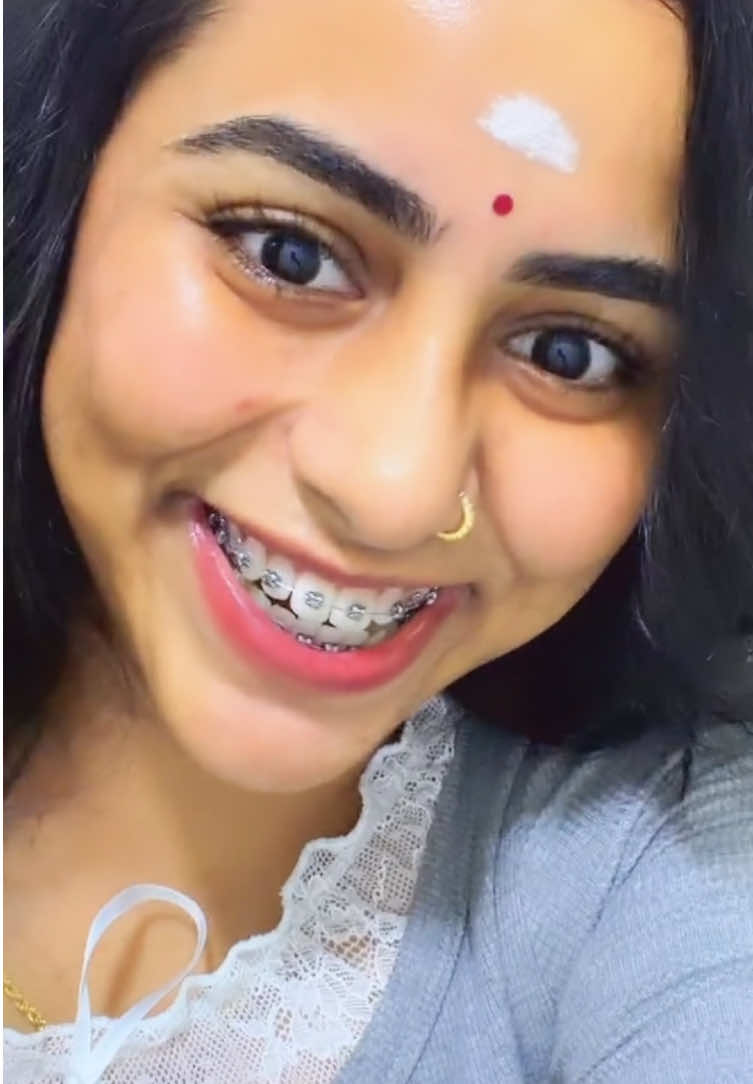 Pray_Trust_Wait🤎😍 #pottu_azhagiye⚫ #ewar #bracesjourney 