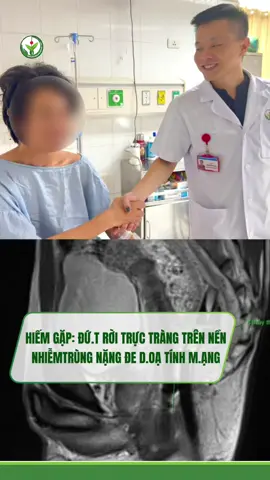 HIẾM GẶP: Đ.ỨT R.ỜI TRỰC TRÀNG TRÊN NỀN N.HIỄM T.RÙNG NẶNG Đ.E D.OẠ T.ÍNH M.ẠNG 🍀 Các bác sĩ B.ệnh viện Hữu nghị Việt Đức đã p.hẫu thuật cấp cứu thành công cho người b.ệnh bị đ.ứt r.ời trực tràng trên nền n.hiễm t.rùng nặng - một tổn thương đặc biệt hiếm gặp, chưa từng ghi nhận trong thực tế lâm sàng tại Việt Nam và trên y văn thế giới cũng chưa có phác đồ điều trị cụ thể. #viral #LearnOnTikTok #benhvienvietduc #bvvietduc #xuhuong 