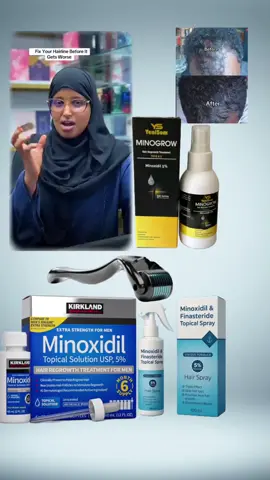 wll nagal soxirir lamabrka profelka saaran#minoxidilresult #minoxidilresult #tyyyyyyyyyyyyyyyyy #typpppppppppppppppppp #minoxidilresult @A_P_ D_A_L_L_E 