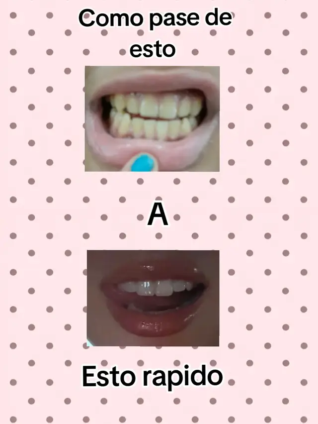 #GlowUp #cepillado #dientes #blancos 