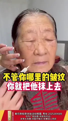 #Improve Forehead Wrinkles, Frown Lines, Nasolabial Folds, Crow's Feet #Beauty #Beauty #Wrinkles Come and see! #Skincare #Beauty #Wrinkles #Event Come and see!