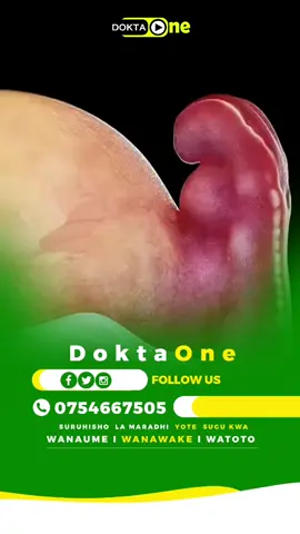 Umewahi Kufahamu Haya Mwanzo? #doktaone 
