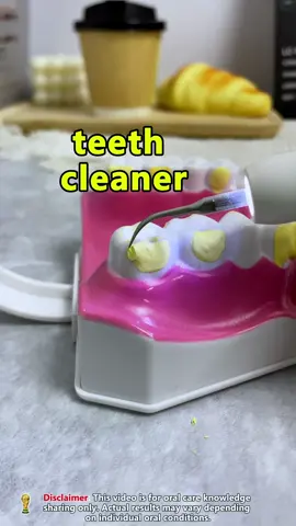 If the tartar in your mouth is very hard, you need this ultrasonic dental cleaner.#ultrasonicscaler #tooth #teethwhitening #tiktokshop #tartar 