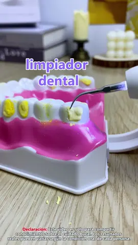 Este limpiador dental ultrasónico es una de las cosas buenas para la limpieza joral en casa. #dentalcleaning #Ultrasonicdescalingagent #fouyou #july7th #tartar 