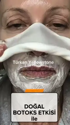 Teyzem 70 ama 40 Görünüyor 💯 ✅Faydaları  Anlık Aydınlık: İçeriğindeki bileşenler sayesinde cilt yüzeyindeki ölü tabakayı arındırır, cildin daha canlı ve pürüzsüz görünmesini sağlar.  Gözle Görülür Sıkılaşma: Yumurta akının doğal gerginleştirici etkisiyle, özel günler öncesi cildin daha diri görünmesine yardımcı olur.  Pürüzsüz Doku: Peçete yöntemiyle uygulandığında, cilt üzerindeki ince tüylerin daha az görünür olmasına ve gözeneklerin temizlenmesine destek olur.  Homojen Görünüm: Cilt yüzeyindeki matlığı aldığı için, renk eşitsizliklerinin daha dengeli görünmesine katkıda bulunur. ✅Malzemeler  Yarım yumurta akı  2 adet bebek aspirini  Birkaç damla su ✅Uygulama 1. Yarım yumurta akını köpürene kadar iyice çırpın. 2. 2 adet bebek aspirinini birkaç damla su ile tamamen eritin ve yumurta akına ekleyip karıştırın. 3. Karışımı temiz cildinize, boyun ve dekolte bölgenize ince bir tabaka halinde sürün. 4. 2 dakika bekledikten sonra üzerine bir peçete yerleştirin (bu süreçte mimik yapmamaya dikkat edin). 5. Peçetenin üzerine karışımın kalanını bir kat daha sürün ve 20-30 dakika bekleyin. 6. Süre sonunda peçeteyi nazikçe çıkarın. Önce ılık, ardından gözeneklerinizi yatıştırmak için soğuk suyla yıkayın. ✅Uygulama Sıklığı  İhtiyaca bağlı olarak haftada 1 kez uygulamanız yeterlidir. Cilt tipinize göre gözlemleyerek devam edin. ⚠️ Önemli Uyarılar  Doktor veya uzman tavsiyesi değildir. Bu bir geleneksel bakım yöntemidir.  Alerji Testi: Uygulamadan önce mutlaka kulak arkası veya bilek içinizde küçük bir bölgede deneme yapın.  Yumurta veya aspirin alerjisi olanlar kesinlikle uygulamamalıdır.  Hamile ve emziren anneler, açık yarası, yoğun sivilcesi veya hassas cilt yapısı olanlar için uygun değildir.  Güneş Koruması: Maske sonrası cildiniz daha hassas olacağı için, gün içinde mutlaka güneş koruyucu krem kullanmayı ihmal etmeyin. ✅Doğal bakım yolculuğumuza ortak olmak için kanalıma abone olmayı ve faydalı bulduğunuz içerikleri paylaşmayı unutmayın!