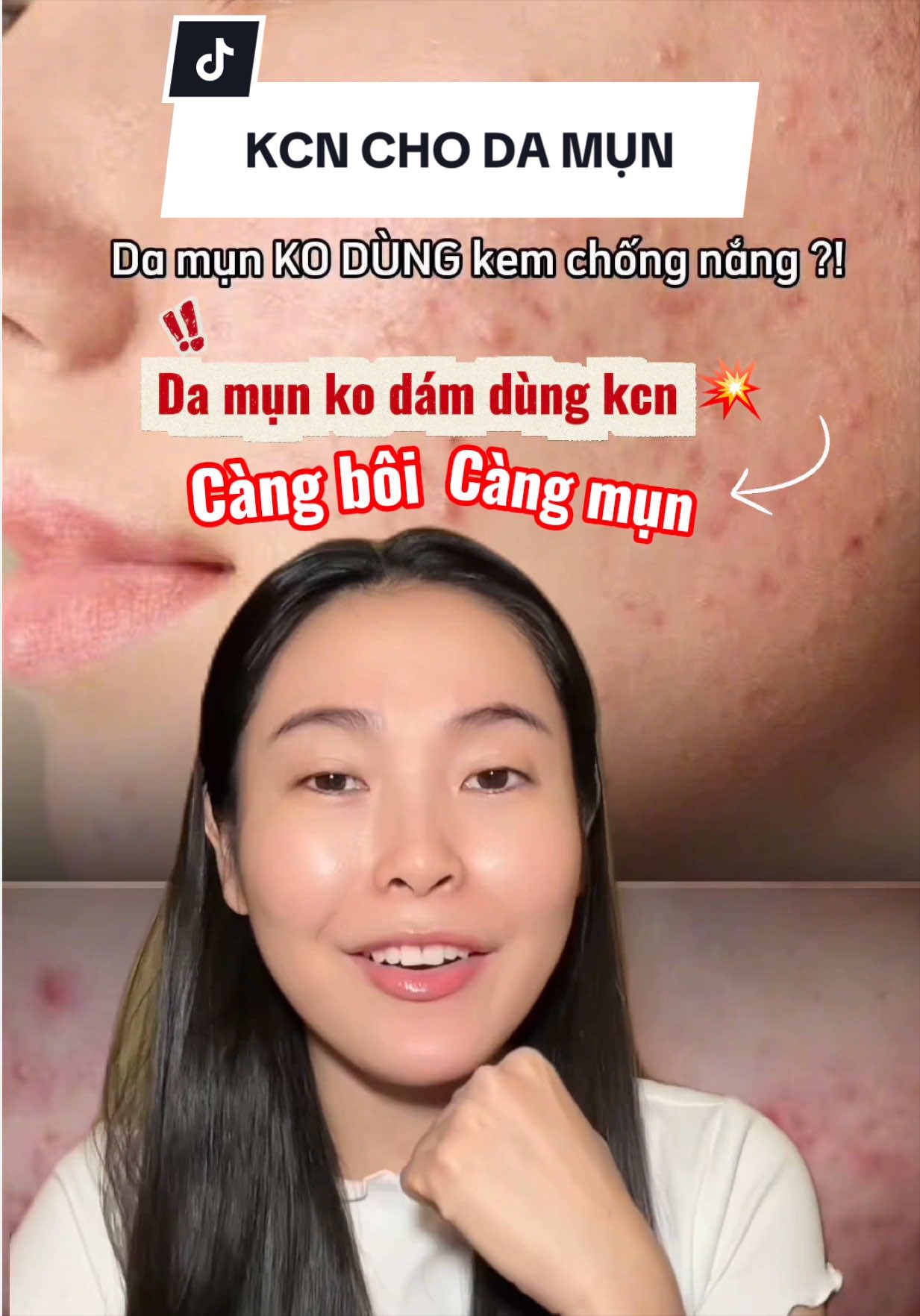 Da dầu mụn chọn kem chống nắng như thế nào cho ổn ?!  #goclamdep #beauty #skincare #chongnangdamun #feldapotheke 