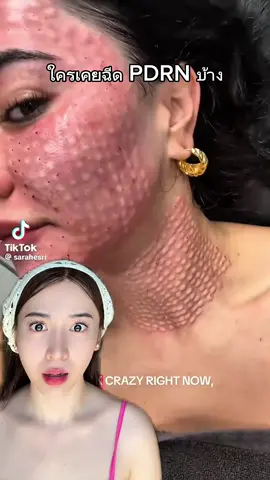 แกเทรนผิวกระจกกำลังมา #มอยส์ผิวเบบี้ ##SkintificPDRN##SkintificTH #PDRN