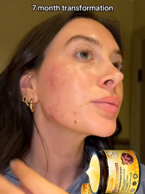🎉Not gonna overhype it, but this bee venom cream has made my skin feel so much tighter and smoother over the past few weeks.