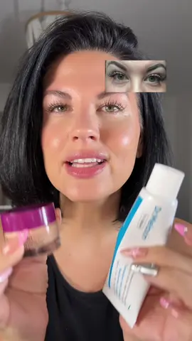 Stop covering - fix it! #darkspots #darkcircles 