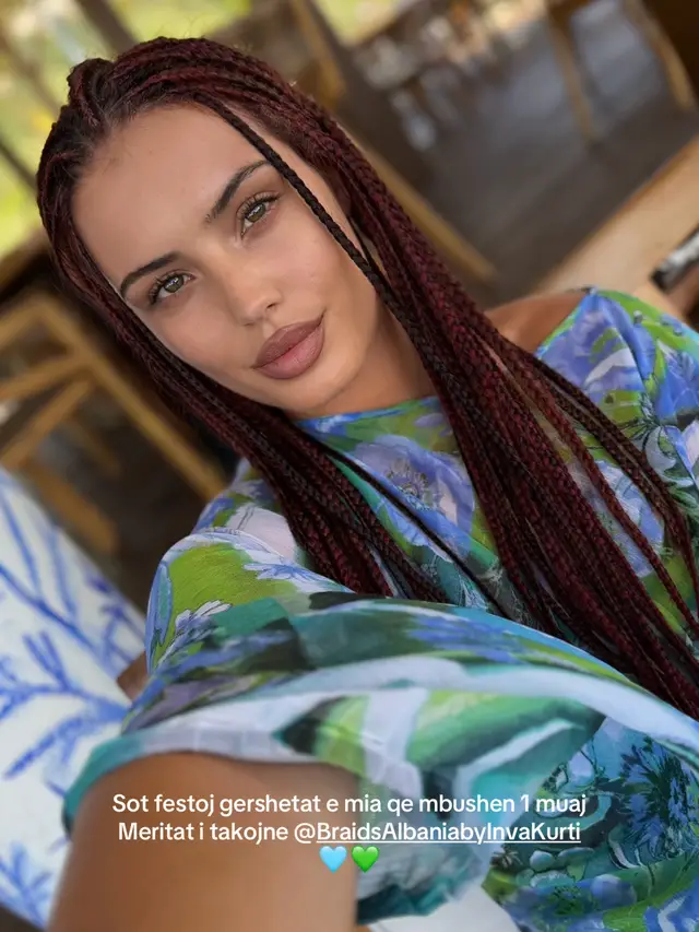 @Braids Albania by Inva Kurti ALWAYS!!! #viral #fyp #albania #braids #Summer 