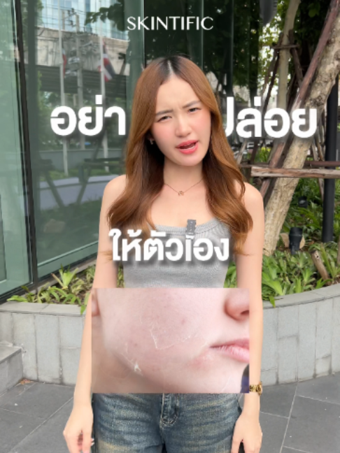 อย่าปล่อยให้ผิวพังแบบไม่รู้ตัว เริ่มดูแลผิวตั้งแต่วันนี้ ด้วยสกินแคร์จาก SKINTIFIC ✨💙 เพราะการมีผิวสุขภาพดี เริ่มต้นจากการบำรุงอย่างสม่ำเสมอ รักตัวเองแล้ว... อย่าลืมดูแลผิวหน้ากันด้วยน้าาา 🫶🏻 #SKINTIFIC #SKINTIFICTH #SKTTH #SKINTIFICNo1SkinBarrier #SKINTIFICขั้นกว่าของเกราะป้องกันผิว #SKINTIFIC5XCERAMIDE #มอยส์5X #มอยส์ฟ้า #คลีนเซอร์SKINTIFIC #คลีนดีมีBarrier #SKINTIFICSkincar #ดูแลตัวเอง #รักตัวเอง