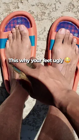 Yes, even your feet need sun protection!  #trulybeauty #sunscreenoil #feetcare #hyperpigmentation #summerwins  