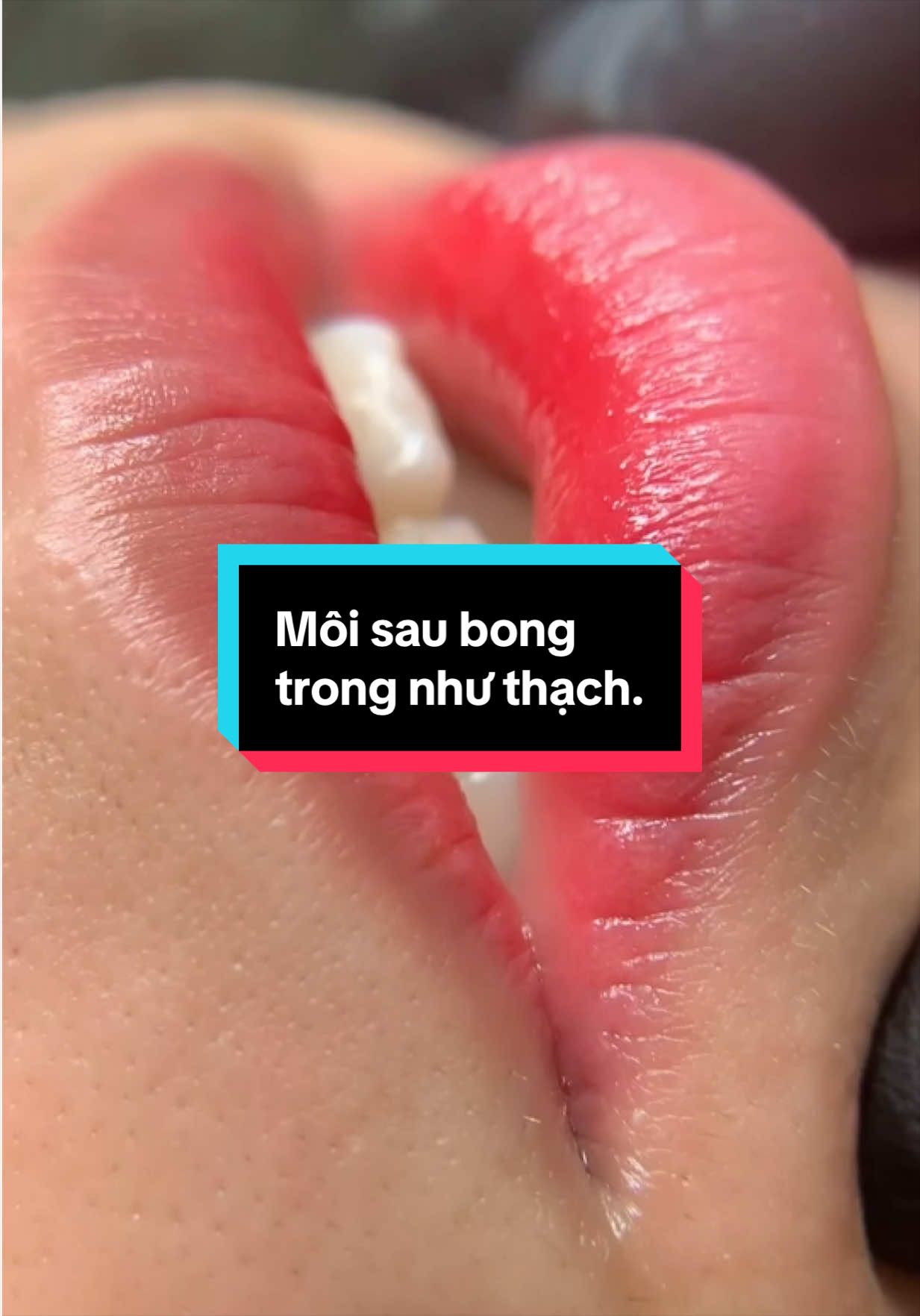 Môi sau bong bên P#phuongphunxam👄 #khuthammoi #phunmoitunhien #phunmoidep #viralvideo 