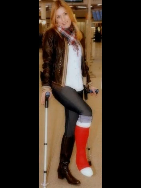 Stefanie Hertel mit Gipsfuß! #krücken #crutches #gips #gesso #platre #gipsfuß #gipsbeen #gipsz #brokenfoot #gehgips #hopping #eingipsen