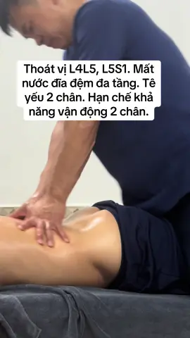 Thoát vị L4L5, L5S1. Mất nước đĩa đệm đa tầng. Tê yếu 2 chân. Hạn chế khả năng vận động 2 chân. #suckhoe #songkhoe #thoatvidiadem #vanphong #xuhuongtiktok 