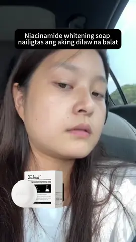 Pano kung gumamit ka nito araw-araw for 7 days? 🤔 MBZ446-lzy #fyp #tiktok #Blackheads #whitening #beauty #SensitiveSkin #knowledge #Niacinamide #salicylicacid #beautytips #sensitiveskinsafe #soap
