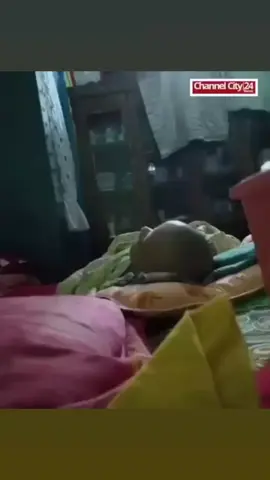 পারিবারিক সমস্যা কারণে আপন চাচি শিশুটার পাও ভেঙ্গে দিল 🥹🥹😭😭😅
