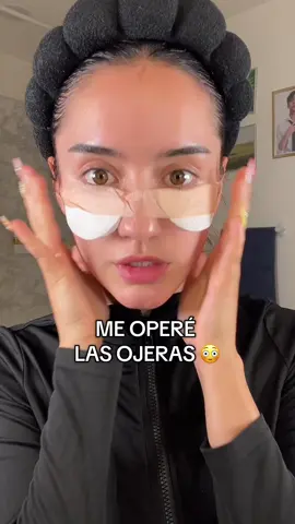 Es que aún no me la creo… 😳 ##ojeras #ojerasoscuras #cuidadodelapiel #skincarecoreano 