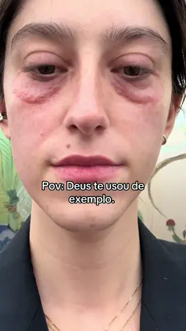 80 anos de idade? #skincare #pov