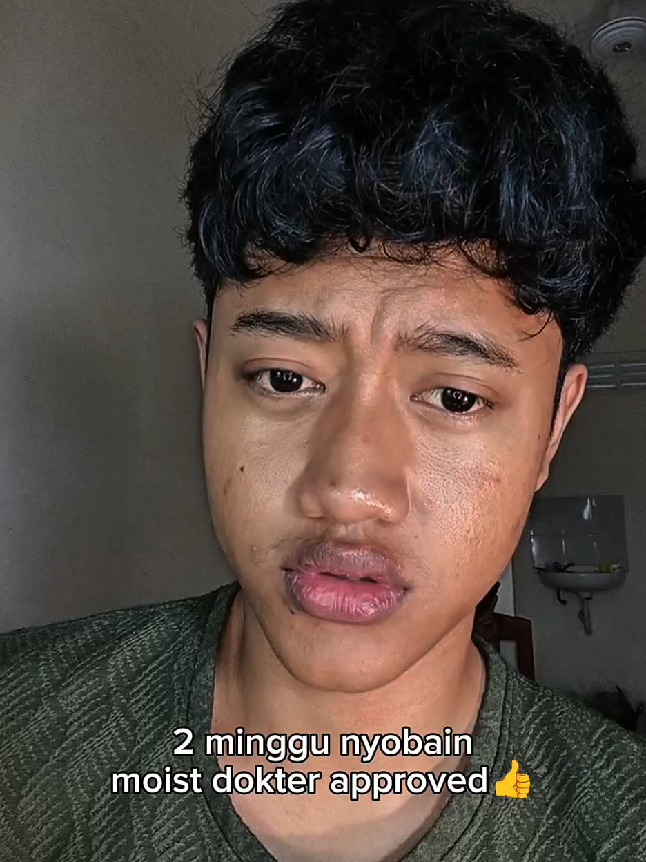 hasilnya GONG BGTT, 2 minggu ga expect beneran sebagus itu moistnyaa