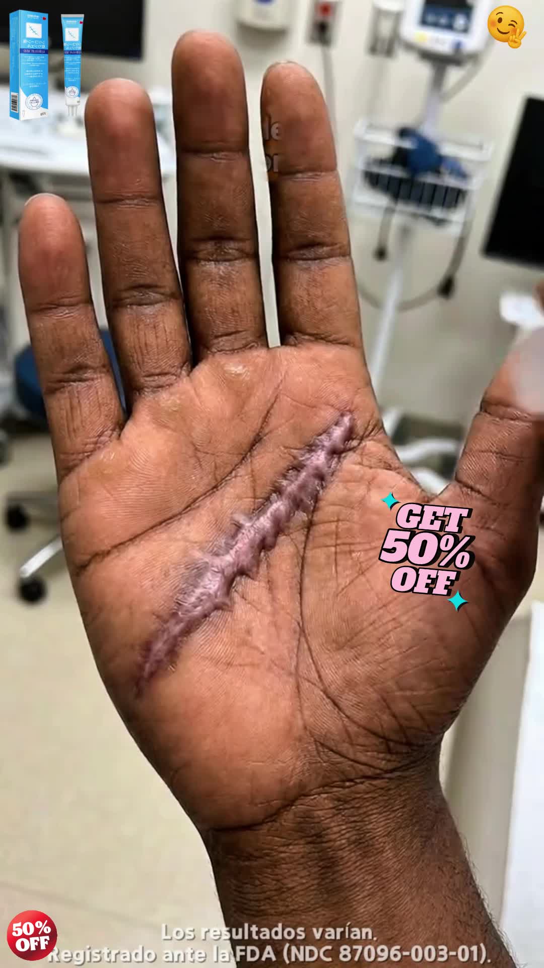 If you're looking for a simple way to care for your scars, now is a great time to try it with the current limited-time offer. #scar #skincare #SelfCare #skinhealth #DailyRoutine