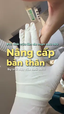 Sắp đẹp roi cố lên 😎😘 #haikamot #duongda #GlowUp #trimun #xuhuong 