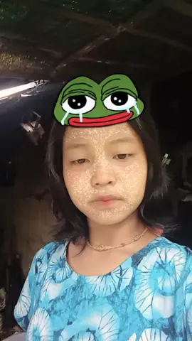 #ရုပ်ဆိုးခြင်းသည်းခံပါ🥺💖 ##