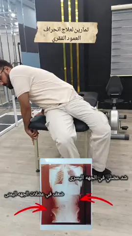 بعد التمارين لعلاج انحراف العمود الفقري  #physiotherapy #cerebralpalsy #عمود_فقري #انحراف_الظهر #scoliosis 