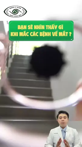 Bạn có bao giờ tự hỏi mình sẽ nhìn thấy gì khi mắc các bệnh về mắt không?  Đầu tiên là đục thủy tinh thể. Mọi vật trở nên mờ đục như nhìn qua một lớp kính phủ sương. Người bệnh thấy thị lực giảm dần, nhìn không rõ, đặc biệt vào ban đêm. Nếu không được xử lý kịp thời, đục thủy tinh thể có thể ảnh hưởng nghiêm trọng đến chất lượng cuộc sống. Tiếp đến là Glocom, hay còn gọi là cườm nước – một trong những nguyên nhân gây mất thị lực hàng đầu. Tầm nhìn sẽ thu hẹp dần như đang nhìn qua một chiếc ống. Điều đáng sợ là bệnh thường tiến triển âm thầm, nhiều người chỉ phát hiện khi thị lực đã tổn thương đáng kể. Và một khi thị lực đã mất do Glocom thì rất khó phục hồi. Một bệnh lý nguy hiểm không kém là viêm màng bồ đào. Người bệnh thường nhìn mờ, đau nhức mắt, chói sáng, đỏ mắt và tái phát nhiều lần. Không ít trường hợp phải dùng thuốc kéo dài hoặc tiêm trực tiếp vào mắt nhưng bệnh vẫn tái đi tái lại. Nếu viêm kéo dài, bệnh có thể gây biến chứng đục thủy tinh thể, tăng nhãn áp và ảnh hưởng thị lực lâu dài. Tại Khải Minh Đường, nhiều bệnh nhân tìm đến sau khi đã điều trị nhiều nơi nhưng chưa ổn định. Hướng tiếp cận tập trung vào việc hỗ trợ cải thiện nền viêm, điều hòa cơ thể và tăng cường khả năng nuôi dưỡng mắt từ bên trong, giúp mắt ổn định hơn và hạn chế tái phát. Đừng bỏ qua những dấu hiệu như nhìn mờ, đau nhức, chói sáng, đỏ mắt hay thị lực giảm dần. Phát hiện sớm luôn là yếu tố quan trọng giúp bảo vệ thị lực và đôi mắt của bạn. #ducthuytinhthe #glocom #cuomnuoc #viemmangbodao #viralvideos