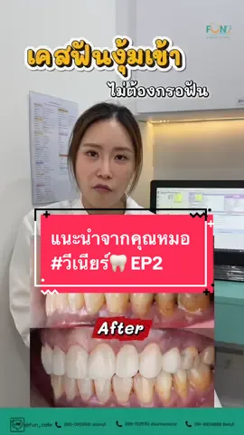 คุณหมอขอแนะนำ ก่อนทำวีเนียร์ ep2 #วีเนียร์ฟันขาว #คลินิกทันตกรรม #คลินิกทันตกรรมฟันคาเฟ่ 
