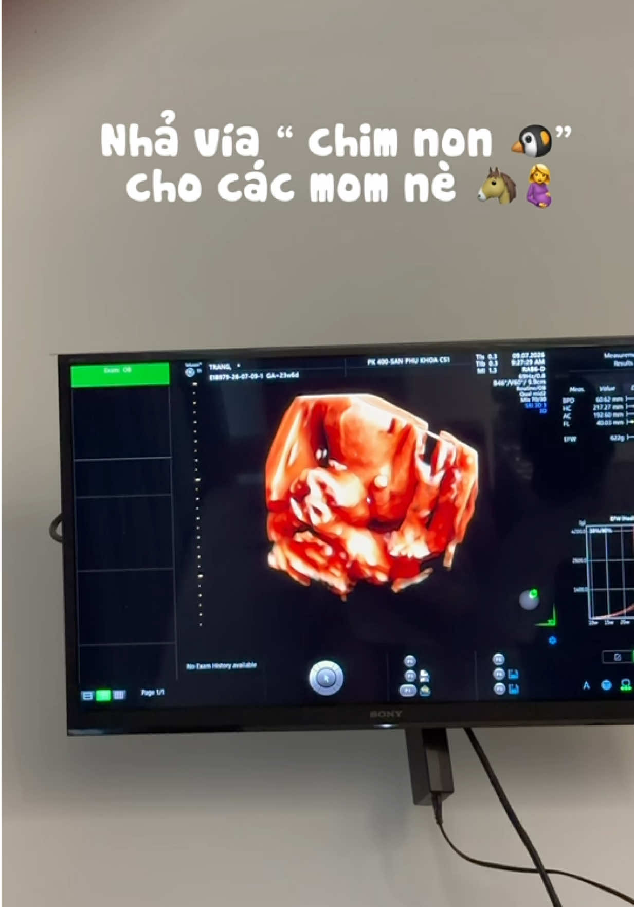 Nhả vía 🐧 cho các mom nè 🤰🐴#giadinhcammi #mebau #mebauthongthai 