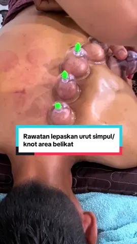 🔥 URAT SIMPUL (KNOT) DI BELIKAT BERJAYA DILEPASKAN! 😣 Belikat terasa keras, tegang dan sakit hingga mengganggu kerja, pemanduan atau tidur? Keadaan ini sering berpunca daripada urat simpul (muscle knot) yang menyebabkan otot menjadi tegang dan pergerakan tidak selesa. Alhamdulillah, selepas proses rawatan melepaskan urat simpul di kawasan belikat, ramai merasakan ketegangan semakin berkurang, badan terasa lebih ringan dan pergerakan bahu serta leher menjadi lebih selesa. 🤲✨ ✅ Fokus pada kawasan urat simpul (knot) yang menyebabkan ketegangan ✅ Membantu mengurangkan kekejangan otot dan rasa tidak selesa ✅ Rawatan mengikut keadaan dan keperluan setiap individu Insya-Allah, dengan izin Allah, kita ikhtiar membantu mengurangkan ketegangan otot dan mengembalikan pergerakan yang lebih selesa. 🌿 📲 Jangan tunggu sehingga urat simpul semakin mencengkam dan mengganggu aktiviti harian. WhatsApp/PM sekarang untuk pertanyaan atau tempahan slot rawatan.#knot #sakitbelikat #urutsaraf #urutantradisional #urut 