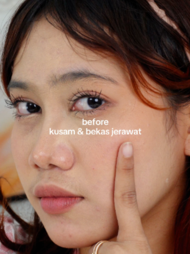 Konsisten merawat kulit itu penting. DRVE Retinol Essence siap jadi andalan skincare kamu. ✨ #drve #glowing #skincare #promoguncang88