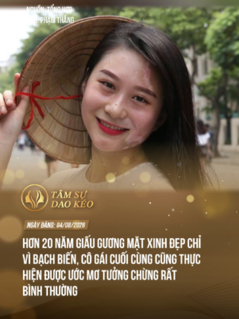 Tiến bộ y học đã giúp cải thiện đến 90% làn da bạch biến cho cô gái, quá là may mắn luôn#theanh28 #tamsudaokeo #tiktoknews #fyp