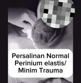 #CapCut #persalinannormal #persalinanminimtrauma #pregnant #pregnancy 