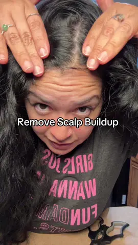 My scalp feels so clean and no more itchiness @Growus #scalpbuildup #itchyscalp#scalpcleanse#scalpcare