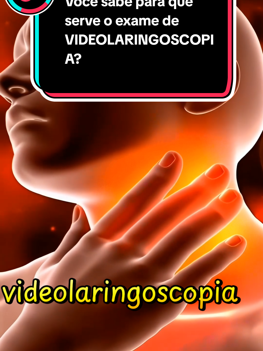 Você sabe para que serve o exame de  VIDEOLARINGOSCOPIA?  #sintomas 
