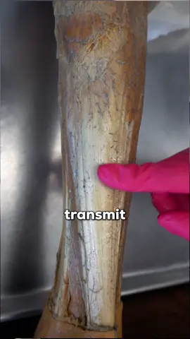 Your muscles get all the attention after a workout, but they're not even the tissue you should be worried about. 🔬 If you want to watch this whole video, it just came out on YouTube. Every time you train, muscle isn't the only thing under stress. Your tendons, ligaments, and cartilage take a beating too. Tendons transmit the force your muscles generate to your bones, ligaments stabilize your joints, and cartilage cuts friction while spreading load across the joint surfaces. Just like muscle, all of these tissues repair and remodel in response to that mechanical loading. Here's the catch. Unlike muscle, most connective tissue has a fairly limited blood supply. That means oxygen, nutrients, and the cells that handle repair reach these structures more slowly, so they recover and adapt more slowly too. And there's a bigger problem. Muscle warns you it's sore. Connective tissue usually doesn't say a word until an overuse injury has already set in. So if you feel real pain in a tendon or joint, it often means something is already wrong. Want the full breakdown? Tap the link in our bio to watch the whole video on YouTube. #recovery #anatomy #humanbody #tendons #ligaments #connectivetissue #cartilage #exercisephysiology #anatomyandphysiology #physiology #medstudent #overuseinjury #musculoskeletal #mobility #iohaanatomy
