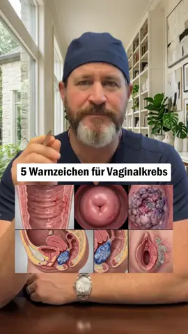 5 Warnzeichen für Vaginalkrebs #vaginalkrebs #frauengesundheit #krebs #symptome #vorsorge 