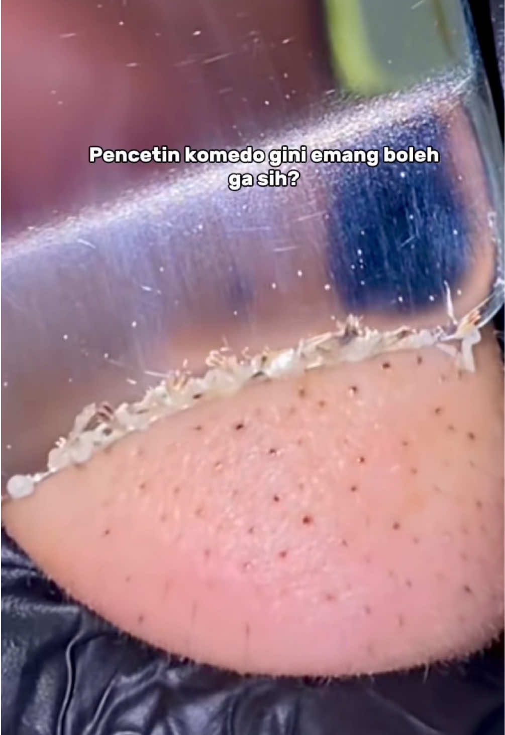 Pliss bgt jangan suka pencetin jerawat‼️😭 rutinin pake masker mugwort aja biar calm #mugwortgelmaskg2g #acnegelmaskviral 