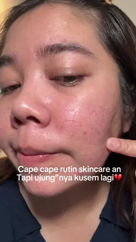 Wajib banget cobain Lightplus combo glowing tahan banting & Hydrashot Intensive Moisturizer Kulit jadi terasa lebih lembab dan keliatan lebih fresh. Apalagi kalau lagi pengen makeup nempel lebih enak, kulit yang cukup hydrated tuh ngaruh banget 🫶🏻 #ComboGlowingTahanBanting #LighterallyMustHave #LightplusbyWardah #lightpluscomboreview 