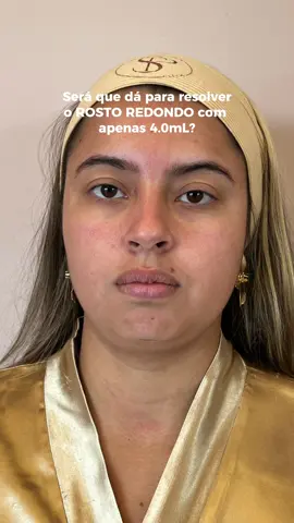 Clique no link da bio e descubra o protocolo ideal para o seu caso 🤎 #esteticafacialecorporal #harmonizacaofacial #ipsclinic #saopaulo 