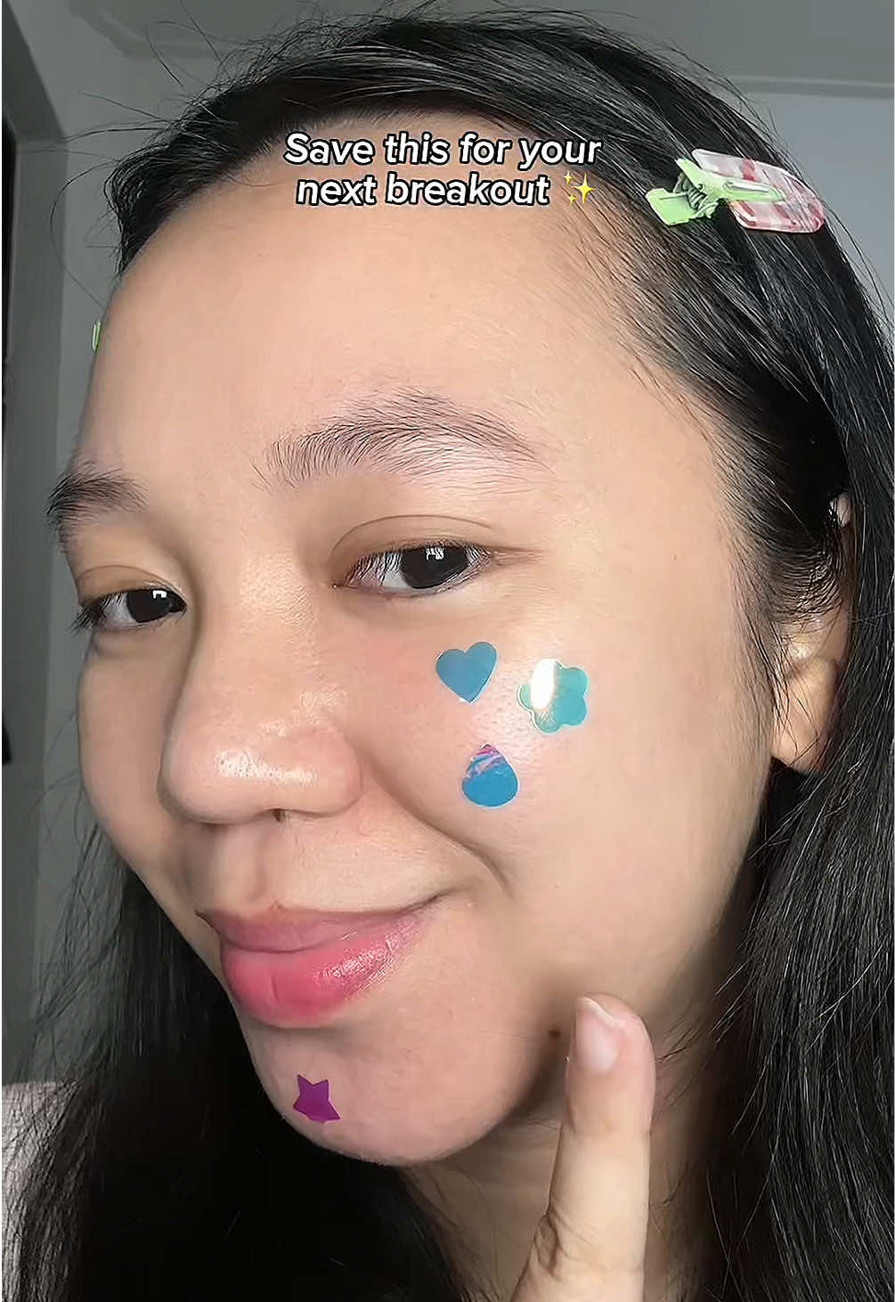 acne patch segemes ini!!😋🌼 #acnepatch #g2gacnepatch #hologramacnepatch 