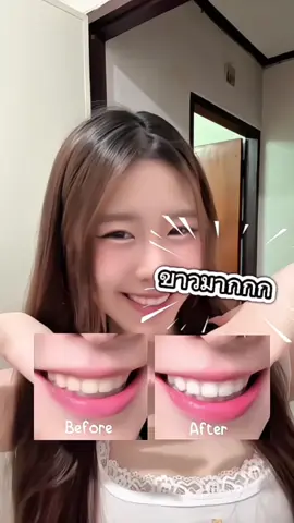#kingbaby #ยาสีฟัน #ยาสีฟันขาว 