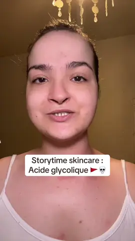 Storytime Skincare 💀 . J’ai fais plusieurs partie ! Si tu as une peau sensible/acneique/rougeâtres et fragile au toucher.  Qu’importe ton âge, n’utilise plus les AHA car leurs composant sont trop chimique et ta peau pourra pas supporter les AHA Et dire que j’ai fais une vidéo sur les bienfaits des produits The ordinary et Medicube 😩😢 Je suis vraiment désolée d’avoir fais ce genre de vidéos qui n’était pas adaptés pour les peaux sensibles .. Je ferais plus attention la prochaine fois 😐 #skincare #routine #aha #viral #pourtoiii 