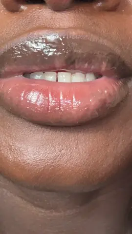 Laka Spicy Lip Plumper gives you fuller smoother lips with a subtle warm tingle. Non sticky lightweight formula that feels comfortable not heavy. Adds beautiful shine and instant volume while deeply hydrating. Leaves lips soft and plump without irritation. Wear alone or layer over lipstick for extra dimension and glow. #LakaLipPlumper #SpicyLipPlumper #LipPlumperGloss #NonStickyGloss #LipGloss     