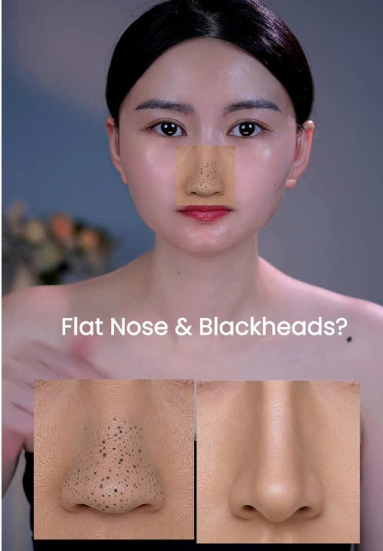 How to Make Your Nose Look More Defined & Clearer#nose #blackhead #skincare #beautytips #koreanskincare 