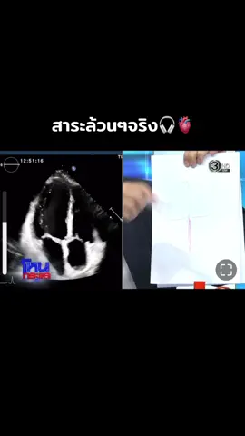#โหนกระแส #โหนกระแสวันนี้ #หัวใจ 